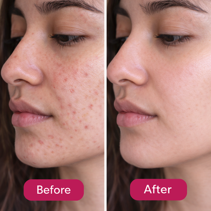 PDRN Pink Peptide Serum