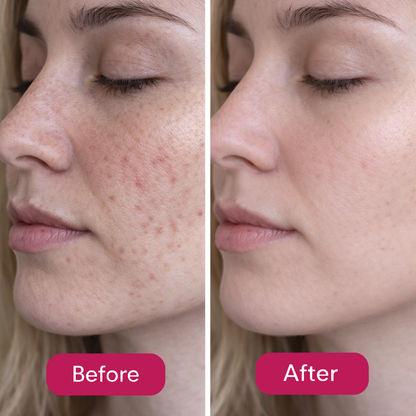 PDRN Pink Peptide Serum